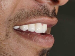 ابتسامة هوليود 07