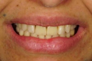 ابتسامة هوليود 09