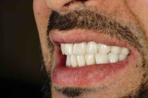 ابتسسامة هوليود 05