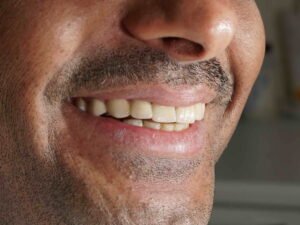 عدسات الايماكس